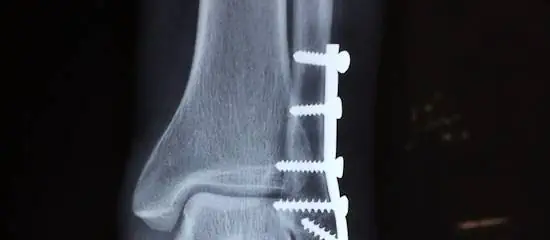 A emergência médica inventada de um burlão.